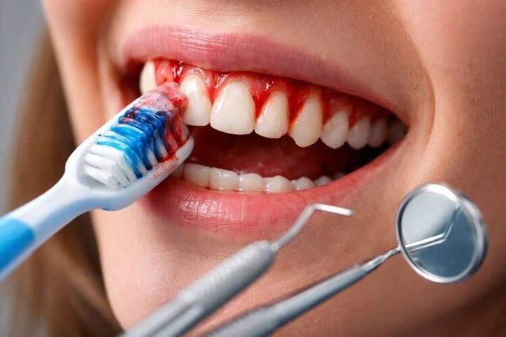 Gum disease treatment service in Jabalpur for healthy gums