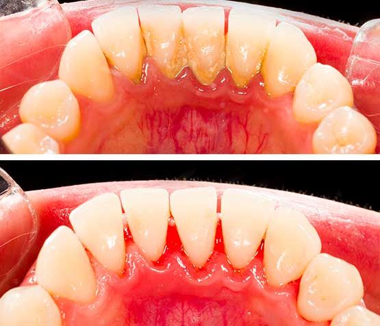best gum treatment dental in jabalpur